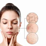 Rejuvenecimiento facial en SkinCenter