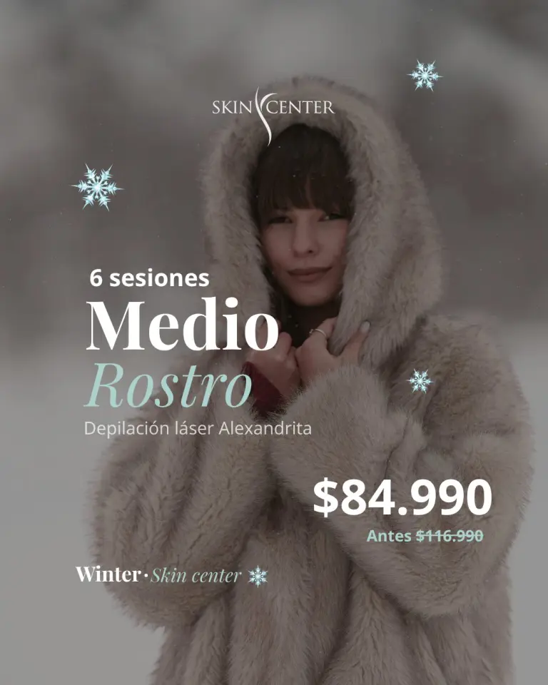 Promocion depilacion laser: 6 sesiones medio rostro
