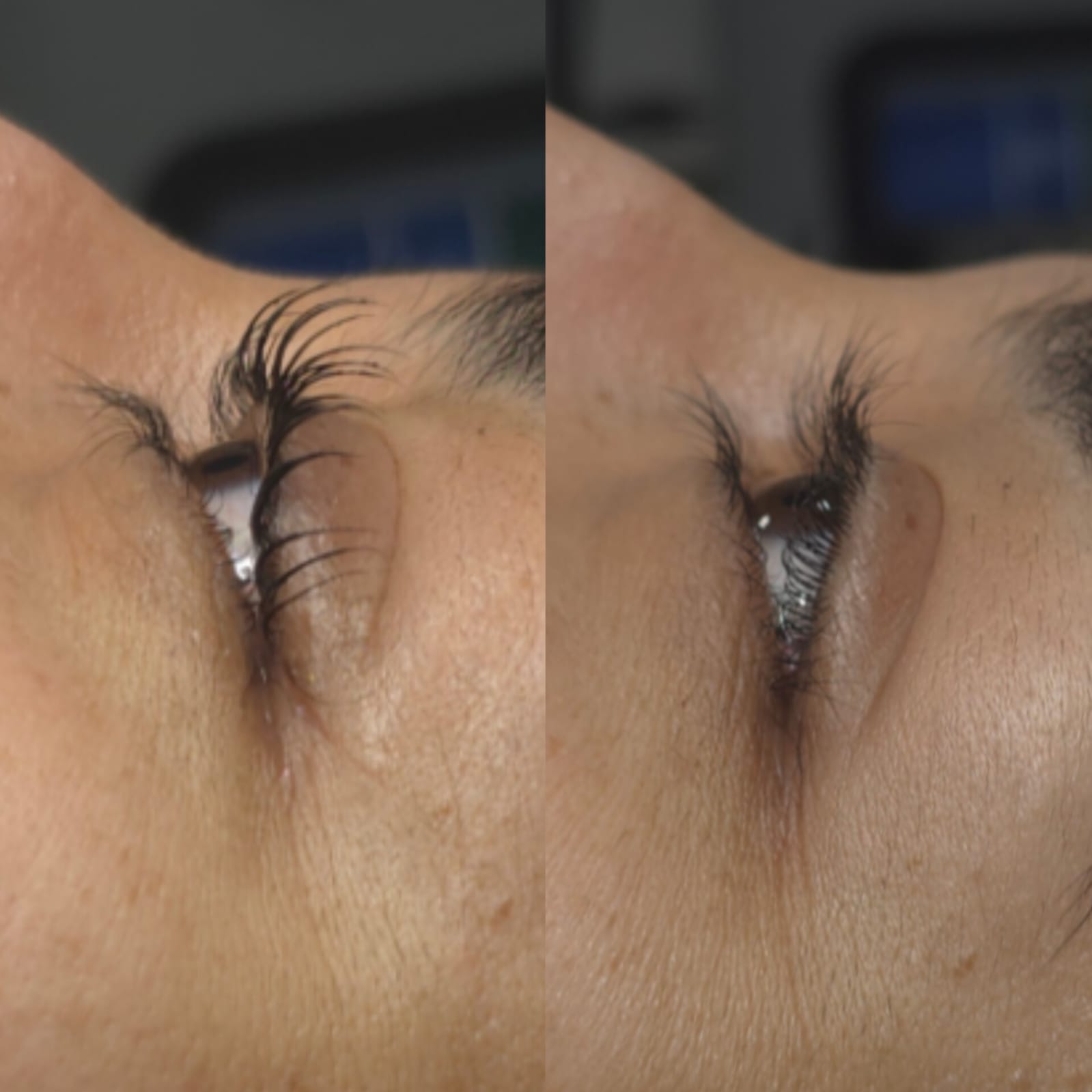Antes y después de lifting de pestañas en SkinCenter Concepción — curvatura desde la raíz