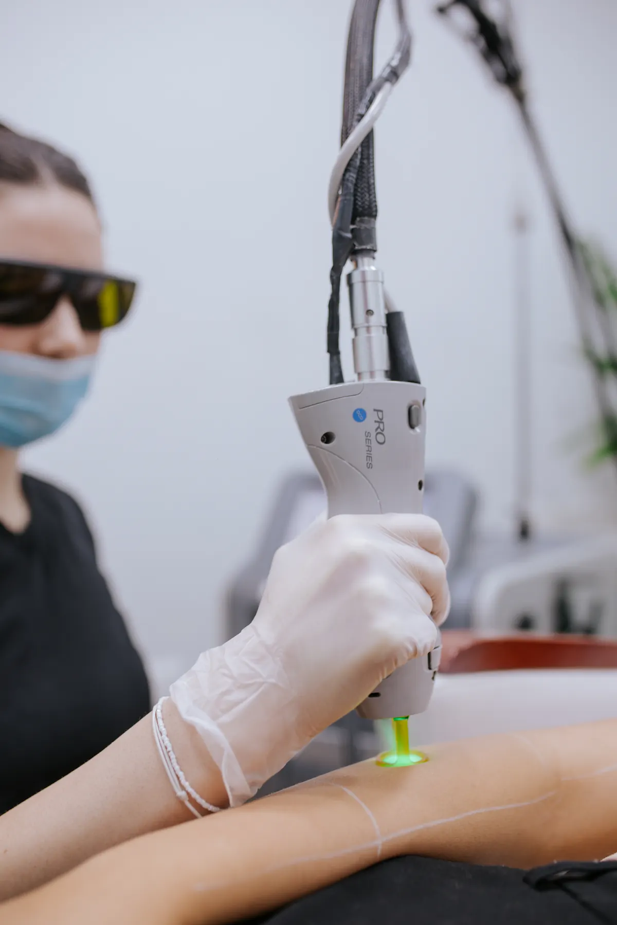 Cabezal del láser Candela GentleLASE Pro de SkinCenter