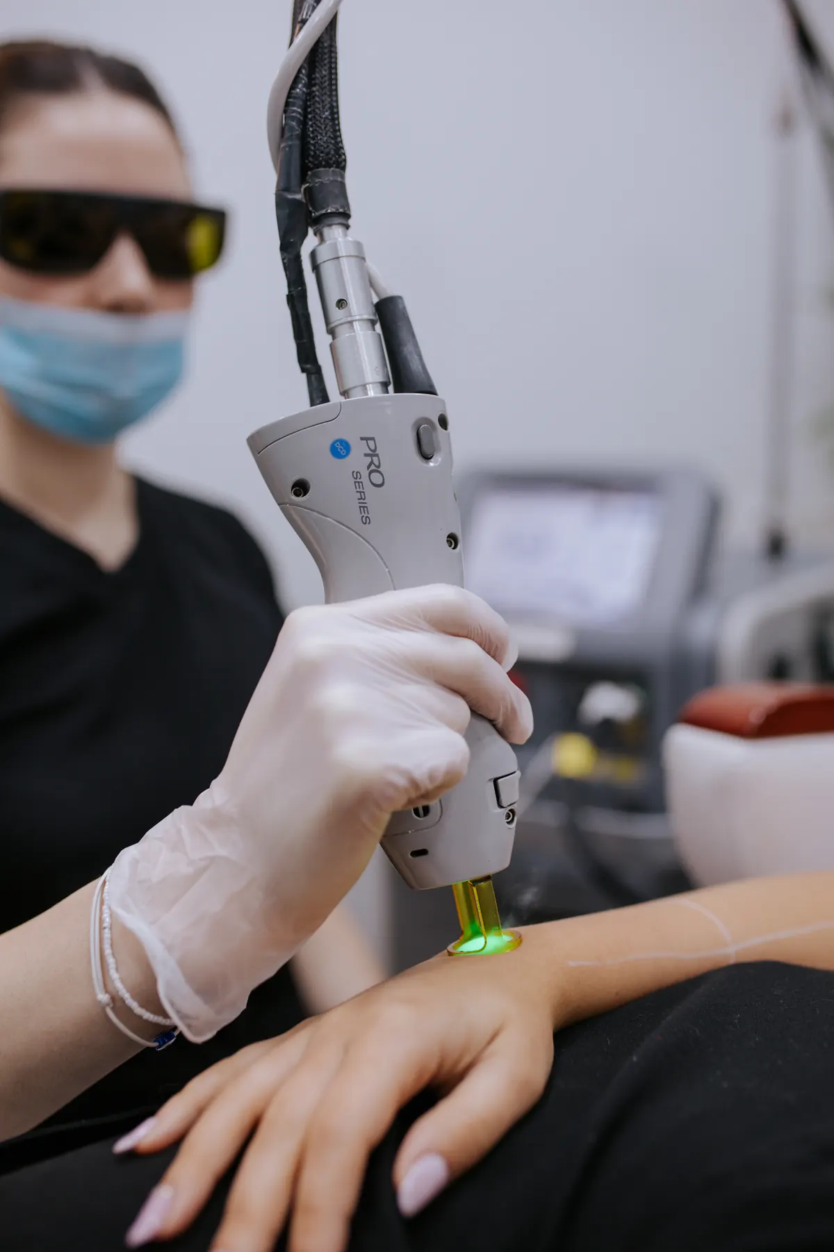 Disparo del láser Candela GentleLASE Pro con haz verde durante una sesión en SkinCenter